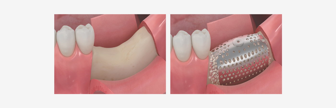 RBG Surgery Box detail (2)q37