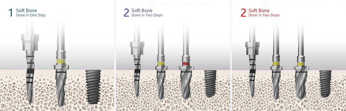 Surgical Kits detail (2)k1d