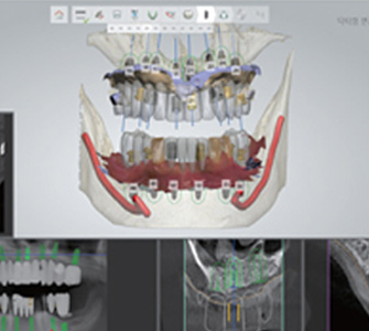 The workflow of Truysou Dentist (3)iq5