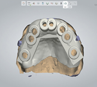 The workflow of Truysou Dentist (4)ok9