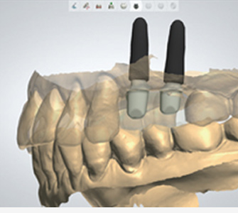 The workflow of Truysou Dentist (5)eiv