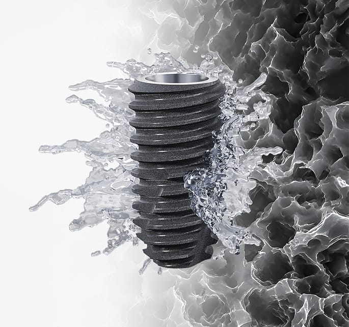 Enhance Patient Outcomes with Select Series Implant Systems desa