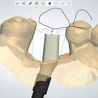 Dental Implant Fabrication and Design.jpg