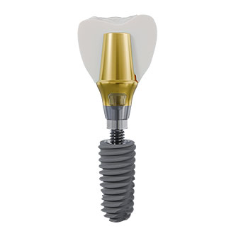 Implant fixation system (1).jpg