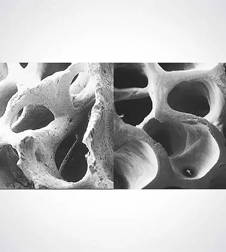 Trusyou-bio Bone Meal: Advanced Biomaterial for Bone Regeneration
