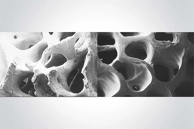 Trusyou-bio Bone Meal An Advanced Biomaterial for Effective Bone Regeneration.jpg