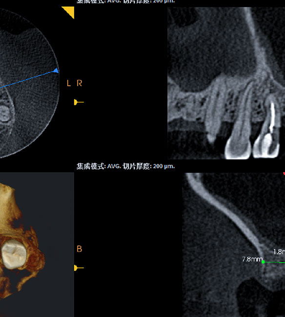Trusyou Implant System Clinical Cases Issue 6