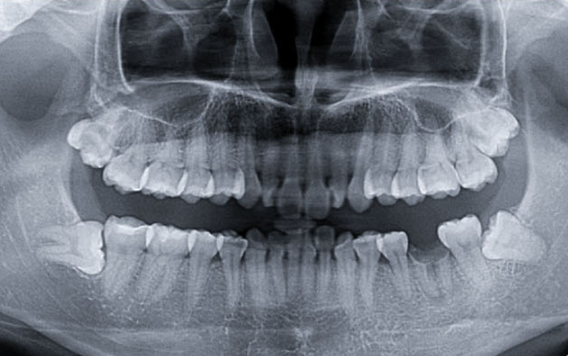 Zhuo Shiyou Implant System Clinical Cases Issue 7 (1).png