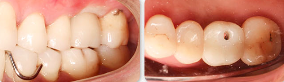 Zhuo Shiyou Implant System Clinical Cases Issue 7 (7).png
