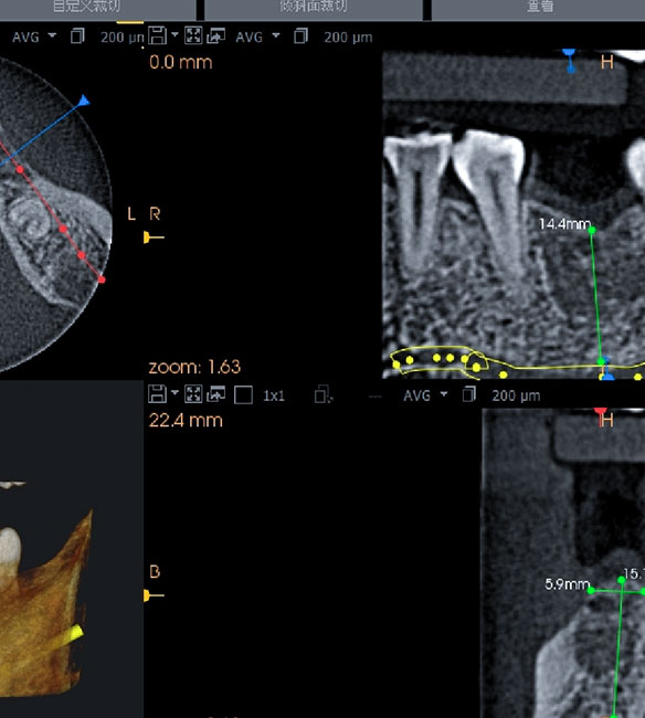 Trusyou Implant System Clinical Cases Issue 7