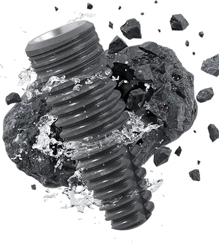 What is a dental abutment and what is its role in dental implants?