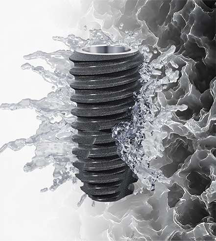 Switzerland's SLA Plus Technology: Revolutionizing Implant Osseointegr