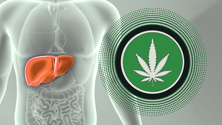 Hepatology International: CBD's Hepatoprotective Properties Confirm Cannabis Reduces Risk of Alcohol-Related Liver Disease
