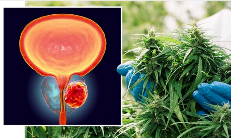 Journal of Medical Cannabis and Cannabinoids: Cannabis May Be an Effective Treatment for Prostate Cancer